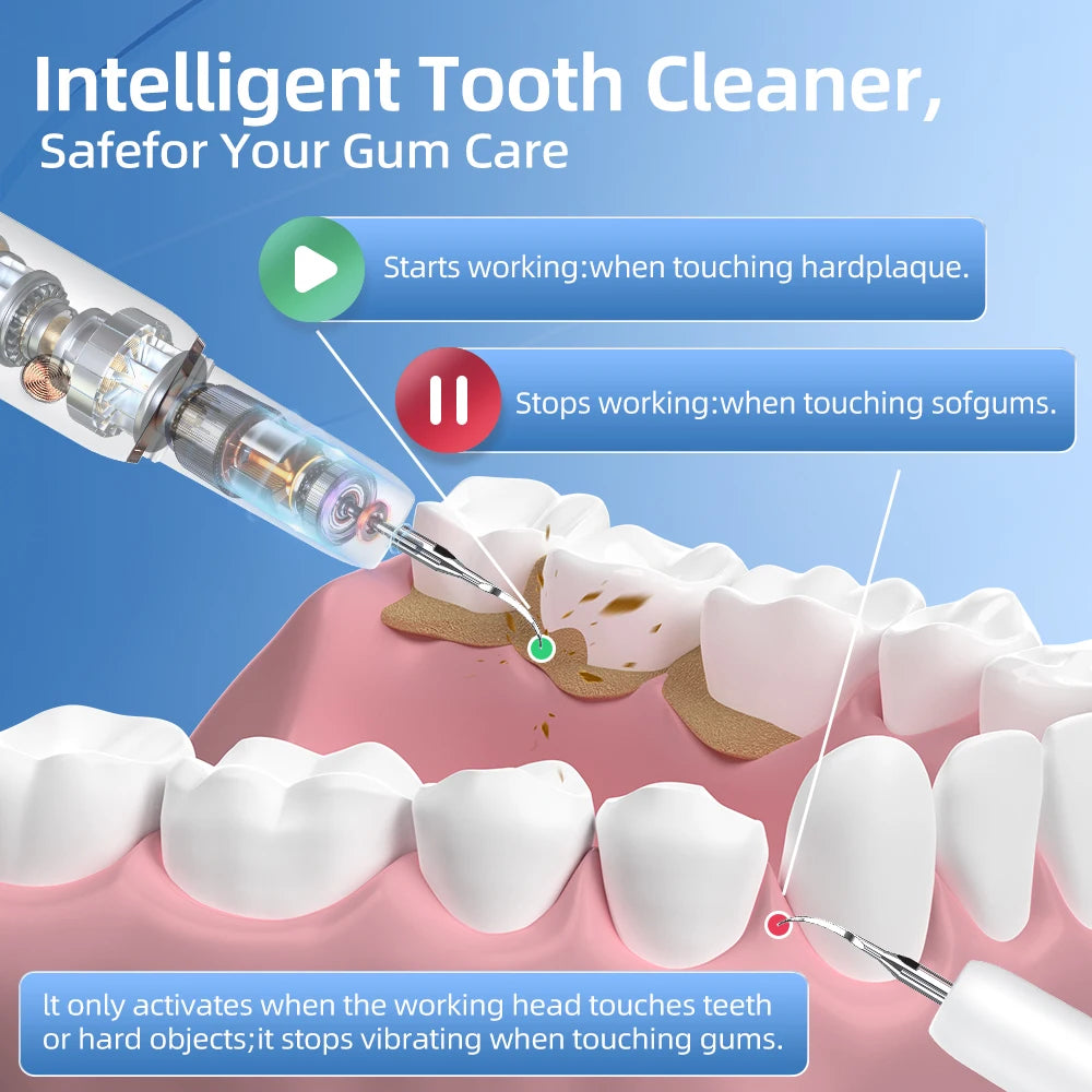 Ultrasonic Dental Cleaner