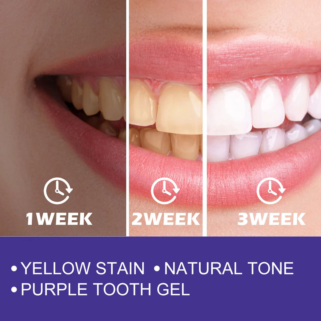 V34 Whitening Toothpaste